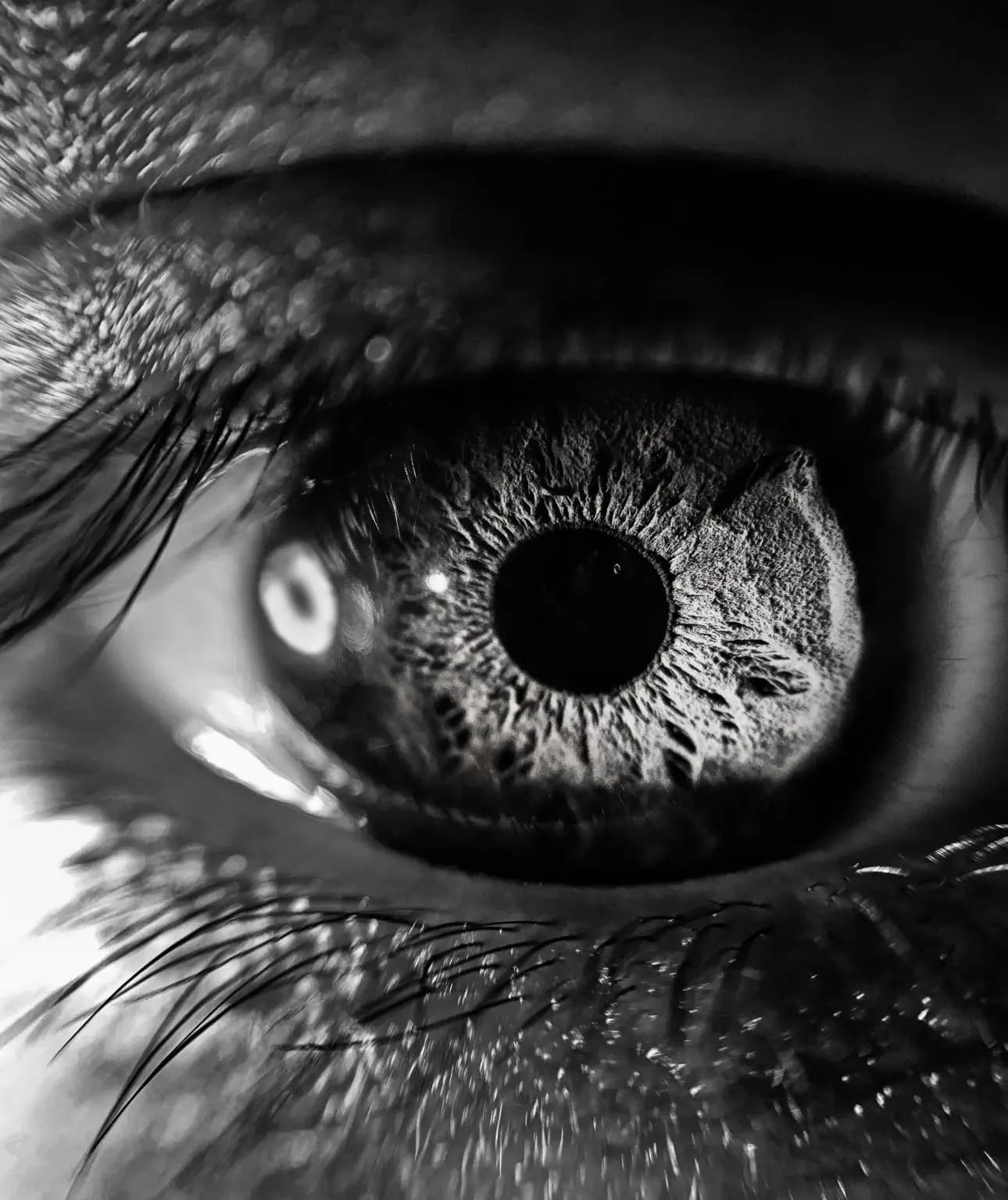 optometrie 1